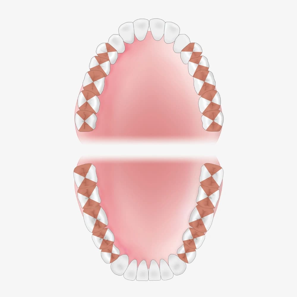 XP² Technology™ Quik-Tip® Double Gracey Mini, posterior B – oficiali American Eagle produkto nuotrauka