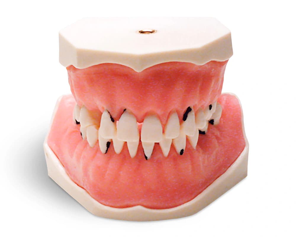 Periodontologinis modelis su fiksuotais dantimis - oficiali GF Dental produkto nuotrauka