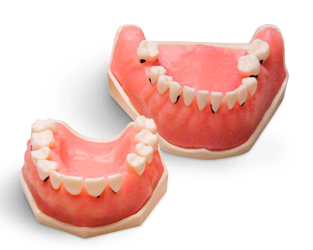 Periodontologinis modelis su fiksuotais dantimis - oficiali GF Dental produkto nuotrauka