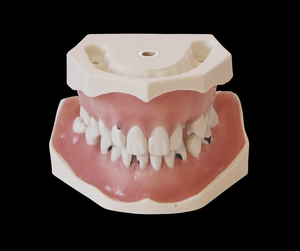 Periodontologinis modelis su prisukamais dantimis - oficiali GF Dental produkto nuotrauka