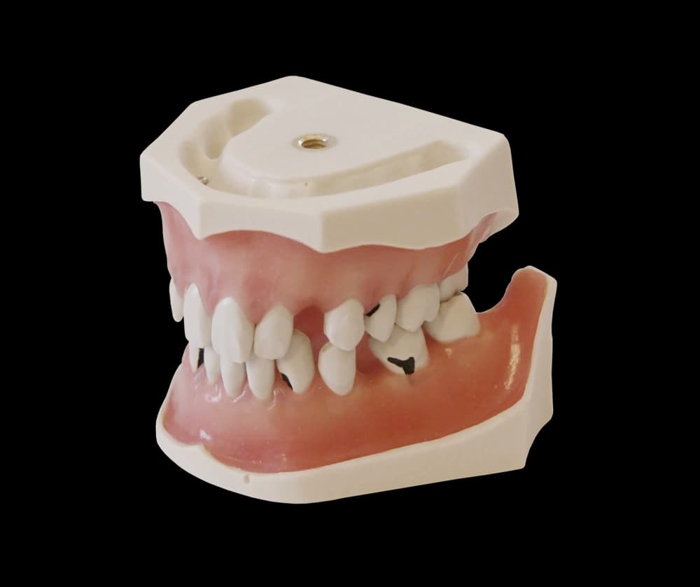Periodontologinis modelis su prisukamais dantimis - oficiali GF Dental produkto nuotrauka