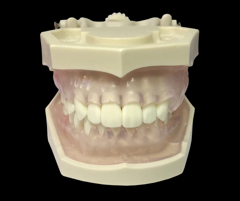 Burnos higienisto modelis su hipertrofinėmis dantenomis - oficiali GF Dental produkto nuotrauka