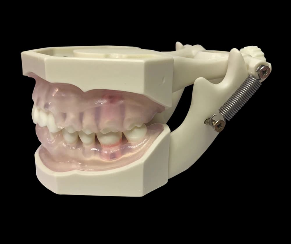 Burnos higienisto modelis su hipertrofinėmis dantenomis - oficiali GF Dental produkto nuotrauka