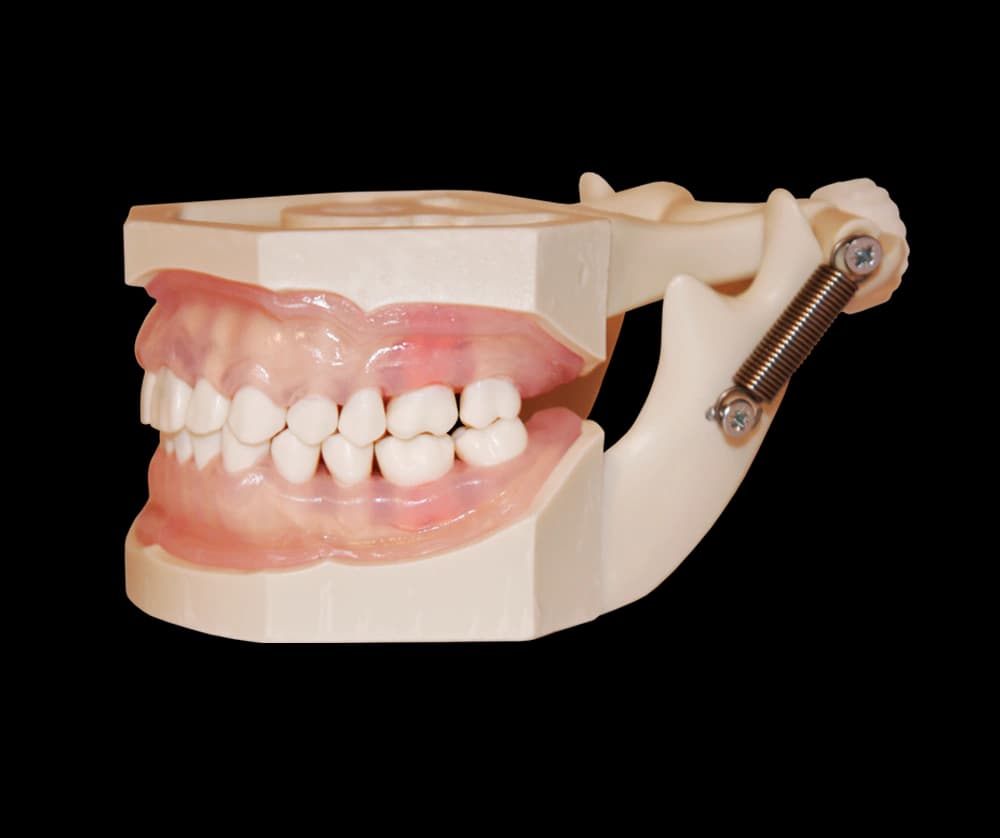 Burnos higienos modelis su implantais - oficiali GF Dental produkto nuotrauka