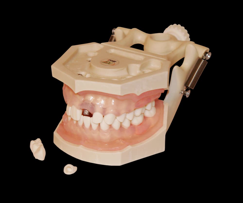 Burnos higienos modelis su implantais - oficiali GF Dental produkto nuotrauka
