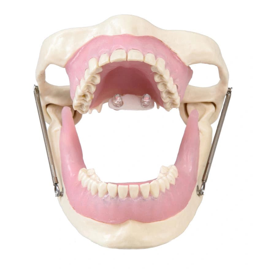 Vietinės nejautros mokomasis modelis - oficiali GF Dental produkto nuotrauka