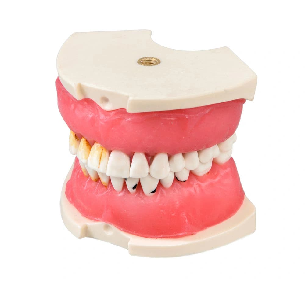Modelis su periodontito pažeistomis dantenomis E26 - oficiali GF Dental produkto nuotrauka