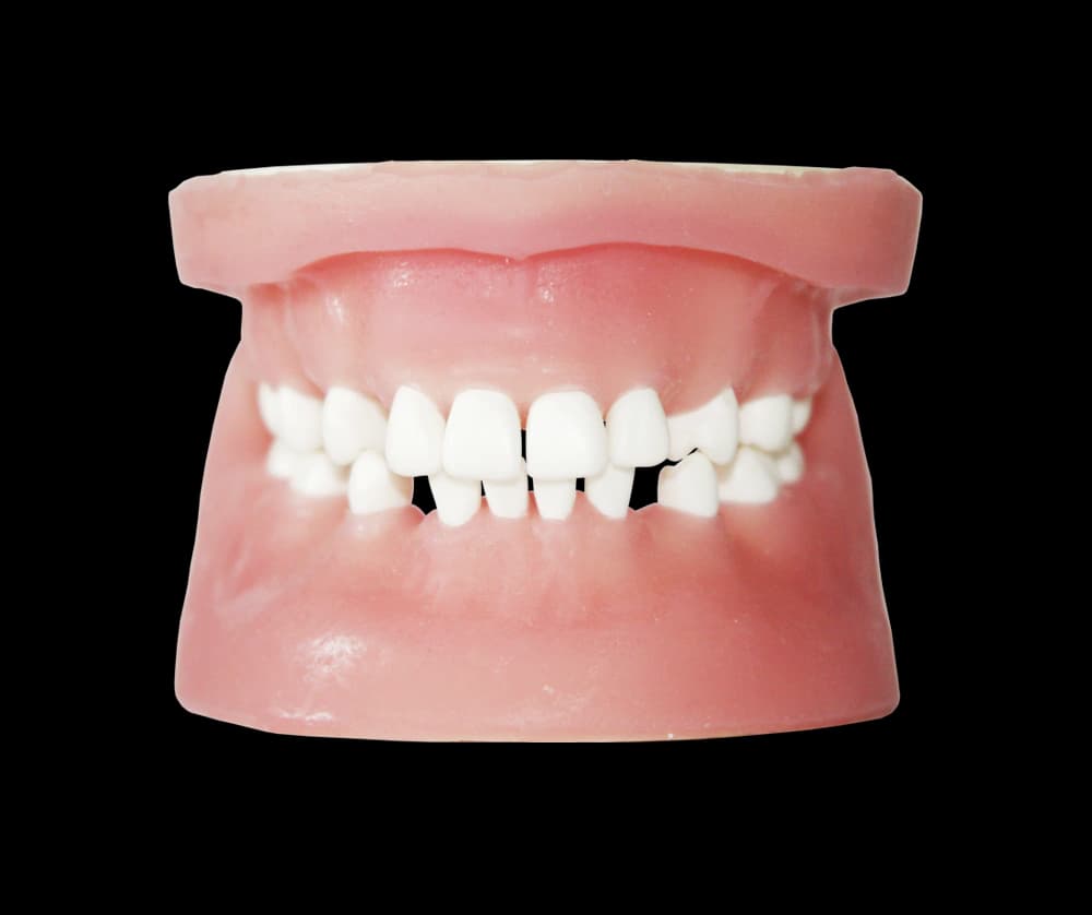 Chirurginės praktikos modelis su rovimui tinkamais dantimis - oficiali GF Dental produkto nuotrauka