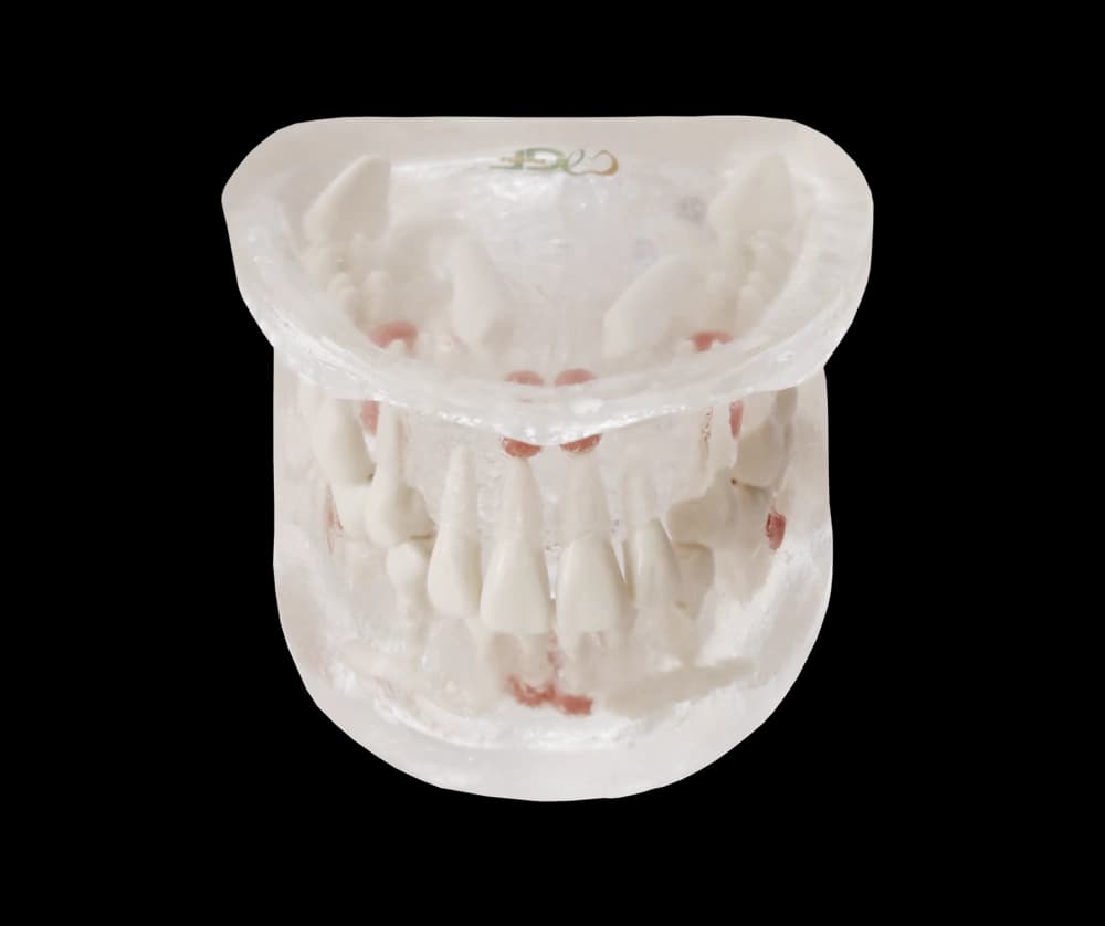 Chirurginės praktikos modelis su rovimui tinkamais dantimis - oficiali GF Dental produkto nuotrauka