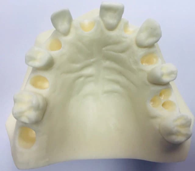 Poekstrakcinės implantologijos žandikaulio modelis E37L - oficiali GF Dental produkto nuotrauka