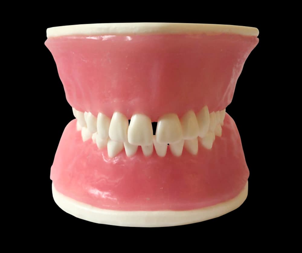 Periodontologinis modelis su fiksuotais dantimis ir siuvamomis dantenomis - oficiali GF Dental produkto nuotrauka