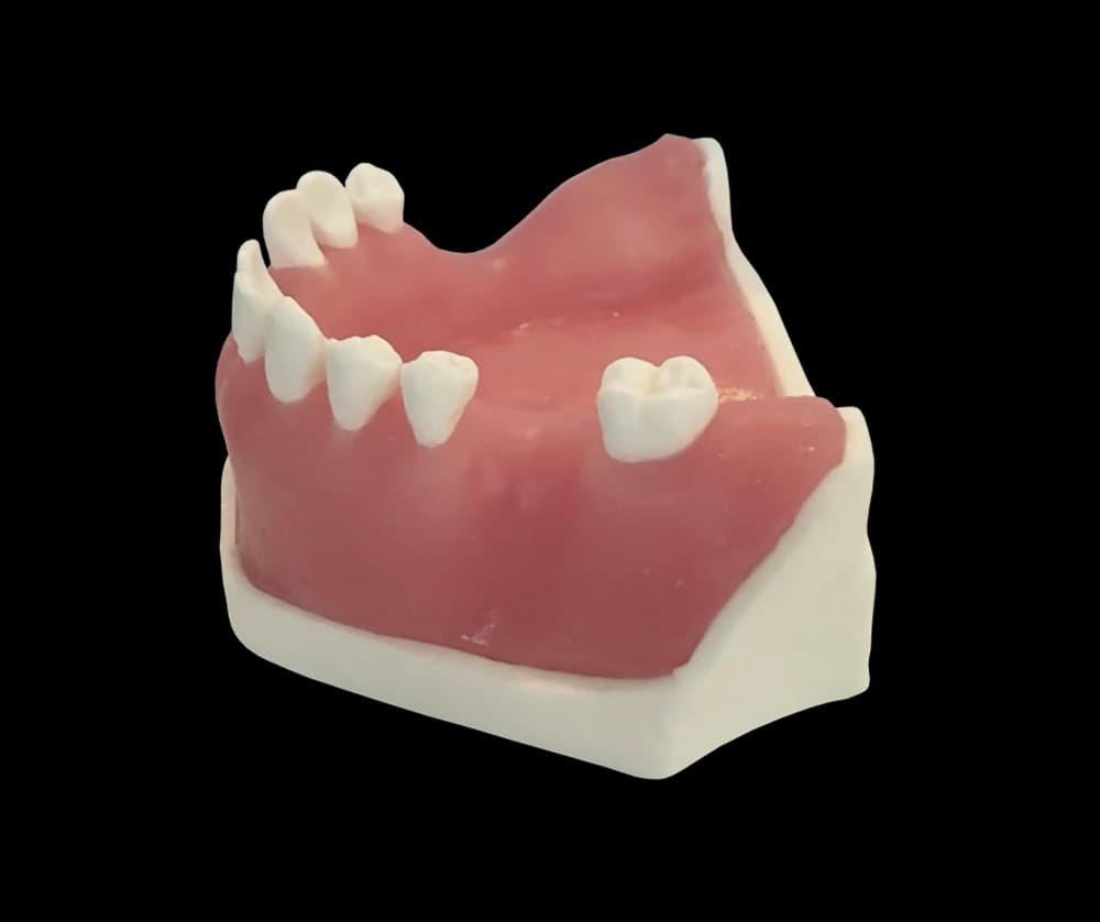 Apatinio žandikaulio modelis kaulo augmentacijos praktikai - oficiali GF Dental produkto nuotrauka