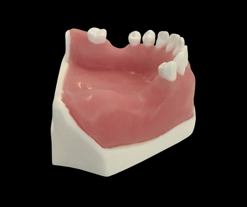 Apatinio žandikaulio modelis kaulo augmentacijos praktikai - oficiali GF Dental produkto nuotrauka