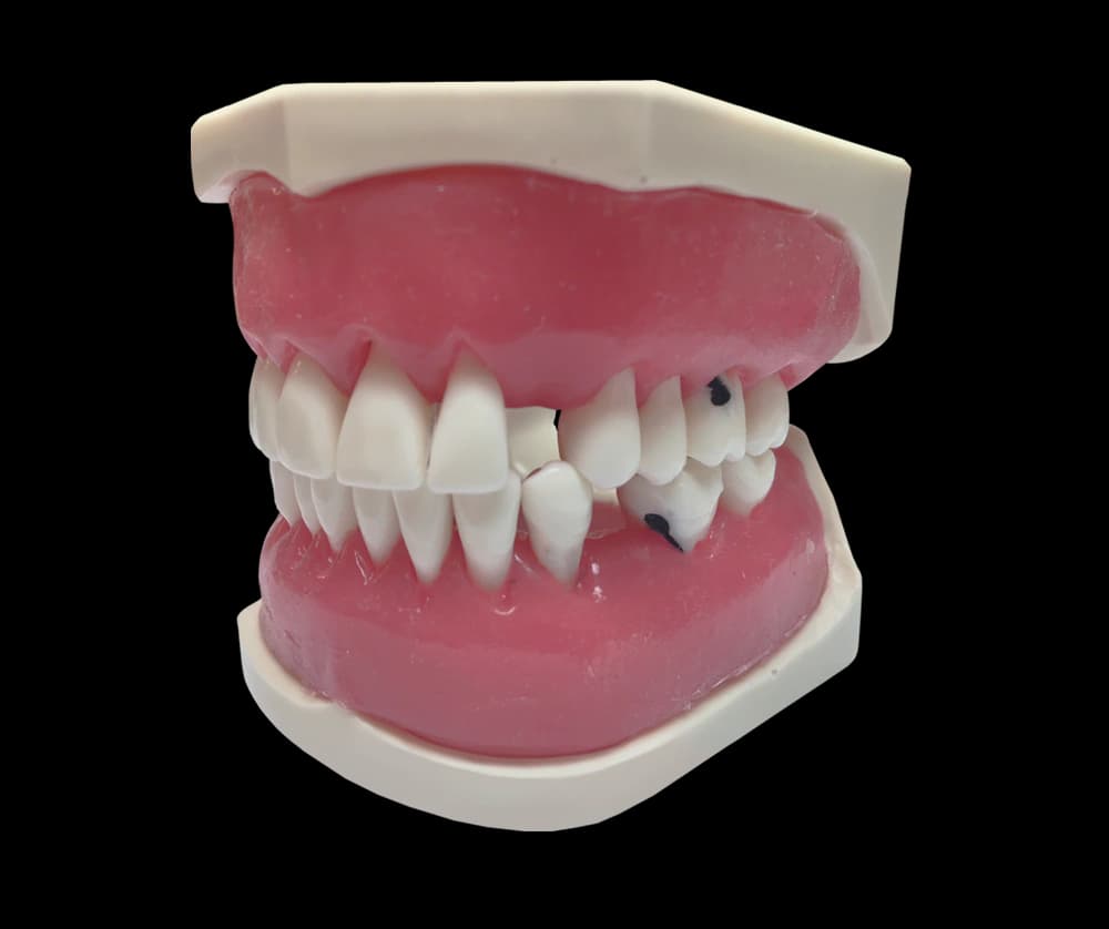 Periodontologinis modelis su prisukamais dantimis ir siuvamomis dantenomis - oficiali GF Dental produkto nuotrauka