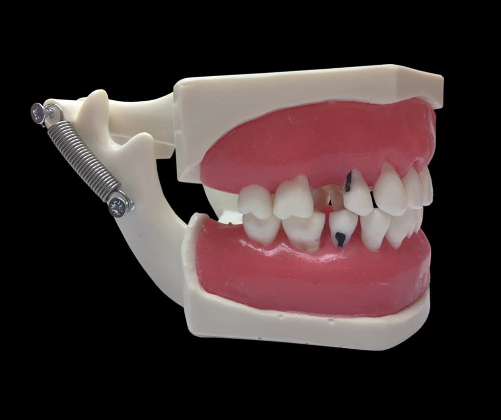 Periodontologinis modelis su prisukamais dantimis ir siuvamomis dantenomis - oficiali GF Dental produkto nuotrauka
