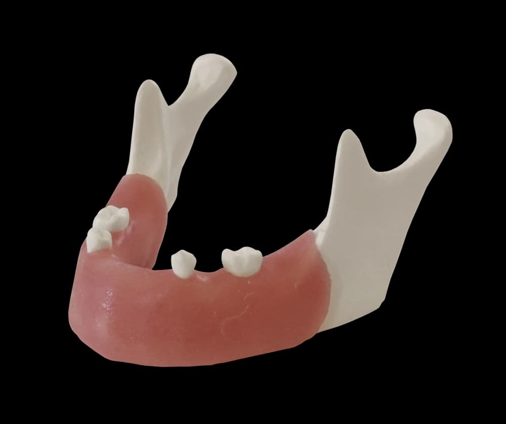 Apatinio žandikaulio modelis implantologijos pratimams E82 - oficiali GF Dental produkto nuotrauka