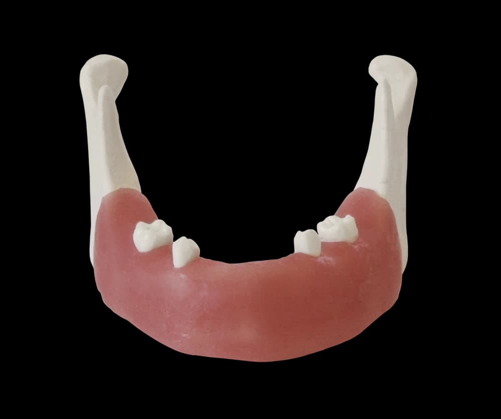 Apatinio žandikaulio modelis implantologijos pratimams E82 - oficiali GF Dental produkto nuotrauka