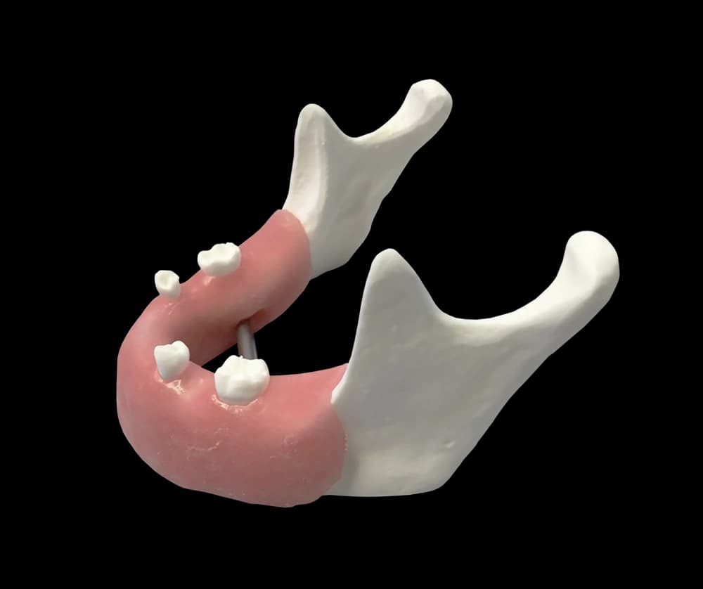 Apatinio žandikaulio modelis implantologijos pratimams E82 - oficiali GF Dental produkto nuotrauka