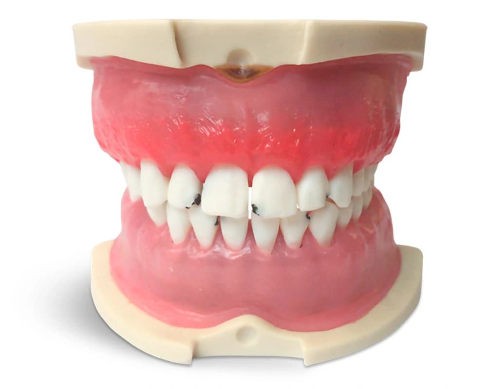 Modelis su periodontito pažeistomis dantenomis E826 - oficiali GF Dental produkto nuotrauka