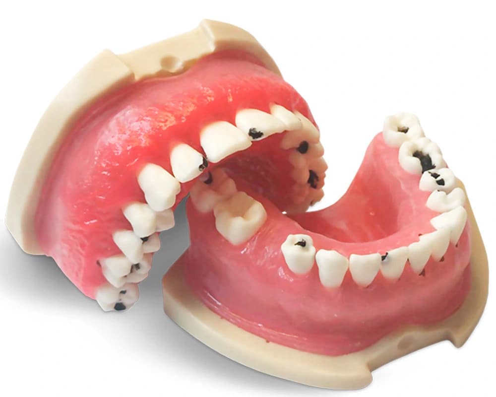 Modelis su periodontito pažeistomis dantenomis E826 - oficiali GF Dental produkto nuotrauka