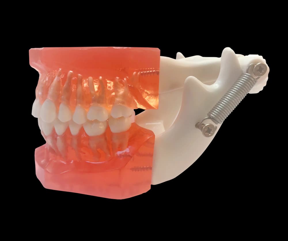 Miniimplantų ortodontinis mokomasis modelis - oficiali GF Dental produkto nuotrauka