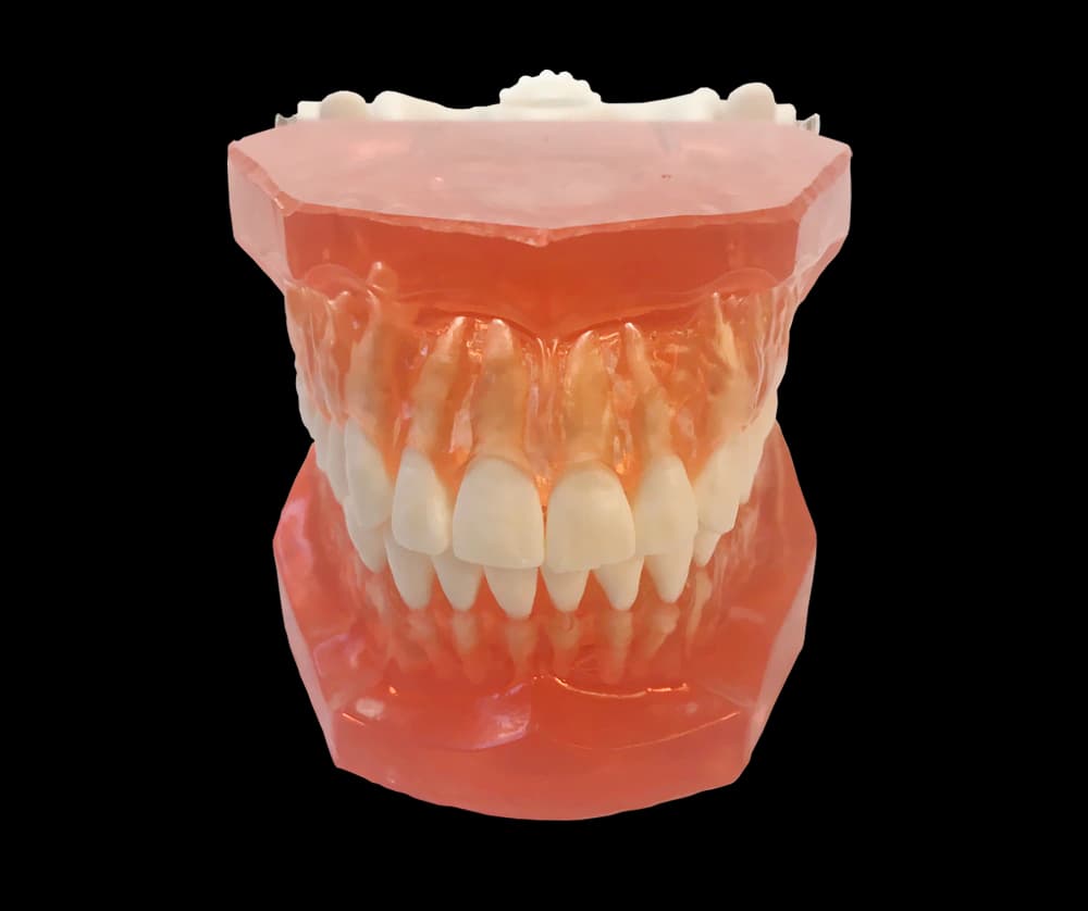 Miniimplantų ortodontinis mokomasis modelis - oficiali GF Dental produkto nuotrauka