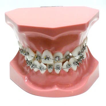 Ortodontinis modelis su priekinių dantų susigrūdimu - oficiali GF Dental produkto nuotrauka