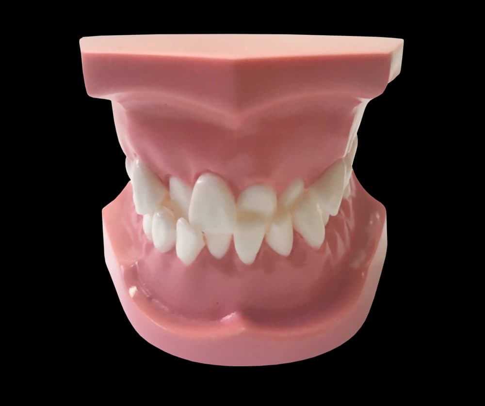 Ortodontinis modelis su priekinių dantų susigrūdimu - oficiali GF Dental produkto nuotrauka