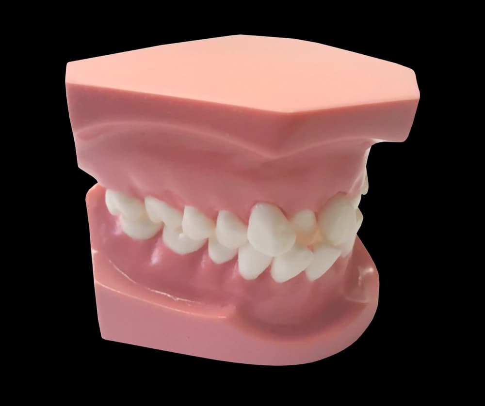 Ortodontinis modelis su priekinių dantų susigrūdimu - oficiali GF Dental produkto nuotrauka