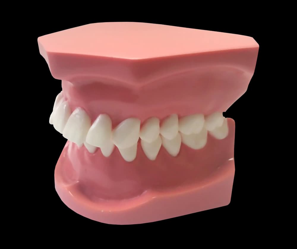 II klasės 1 poklasio ortodontinis modelis - oficiali GF Dental produkto nuotrauka