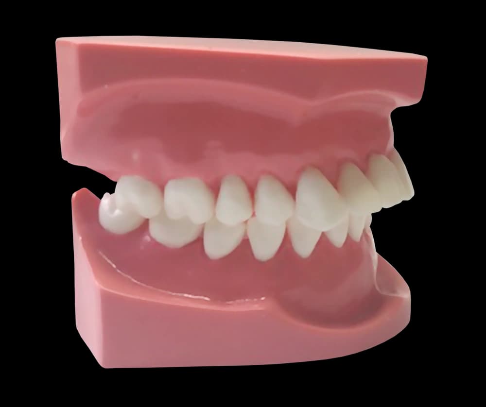 II klasės 1 poklasio ortodontinis modelis - oficiali GF Dental produkto nuotrauka