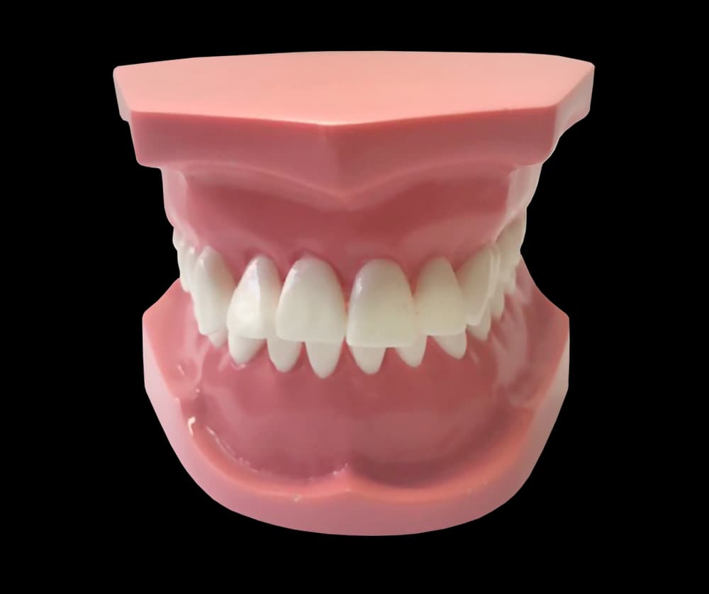 II klasės 1 poklasio ortodontinis modelis - oficiali GF Dental produkto nuotrauka