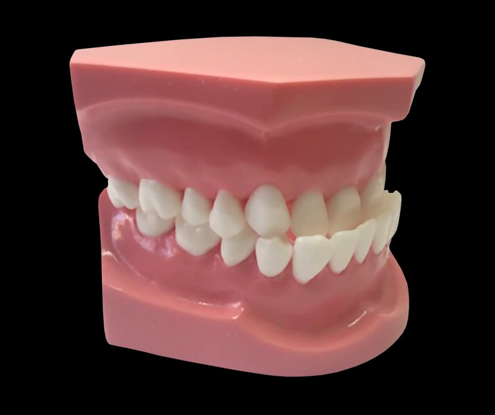III klasės ortodontinis modelis - oficiali GF Dental produkto nuotrauka