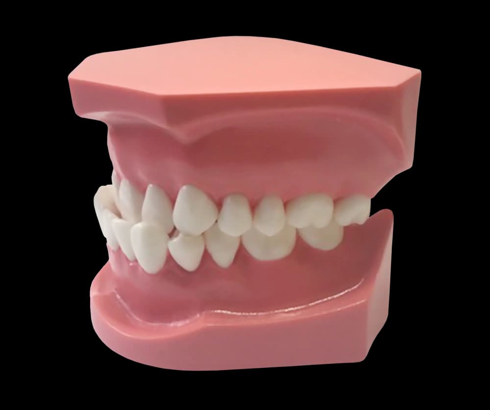III klasės ortodontinis modelis - oficiali GF Dental produkto nuotrauka