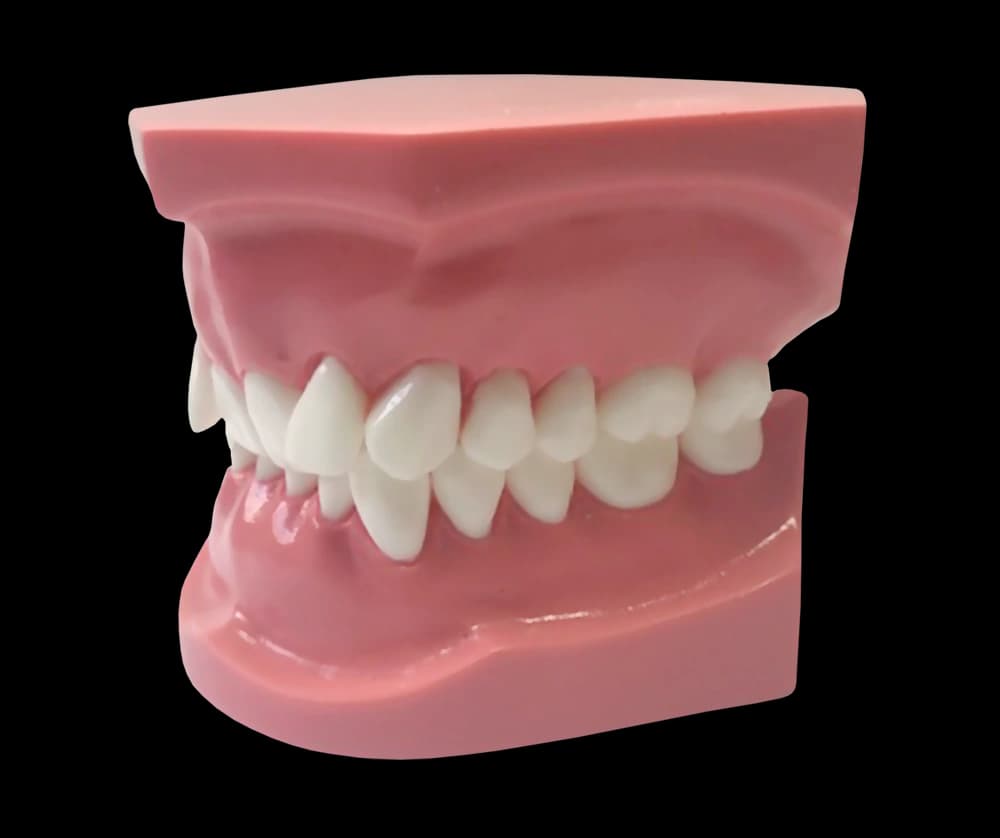 II klasės 2 poklasio ortodontinis modelis - oficiali GF Dental produkto nuotrauka