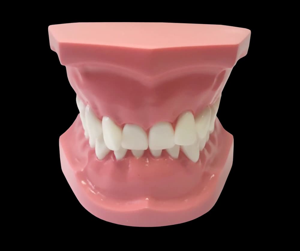 II klasės 2 poklasio ortodontinis modelis - oficiali GF Dental produkto nuotrauka