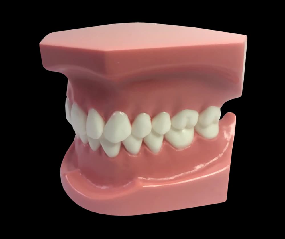I klasės ortodontinis modelis su breketais - oficiali GF Dental produkto nuotrauka