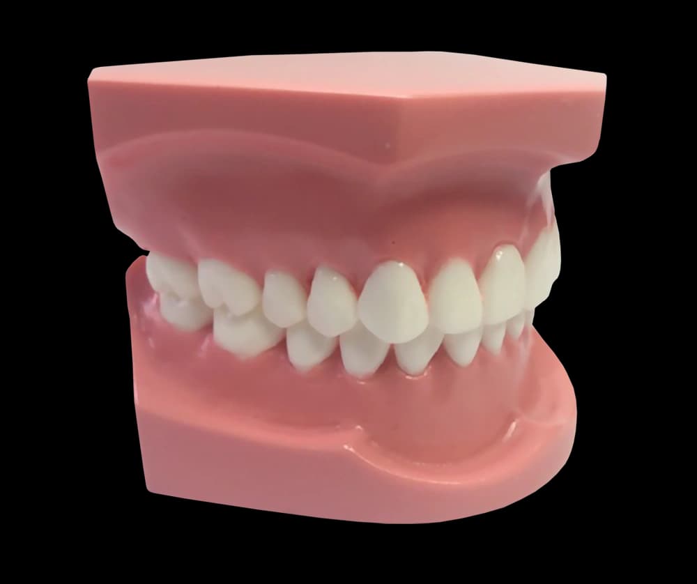 I klasės ortodontinis modelis su breketais - oficiali GF Dental produkto nuotrauka