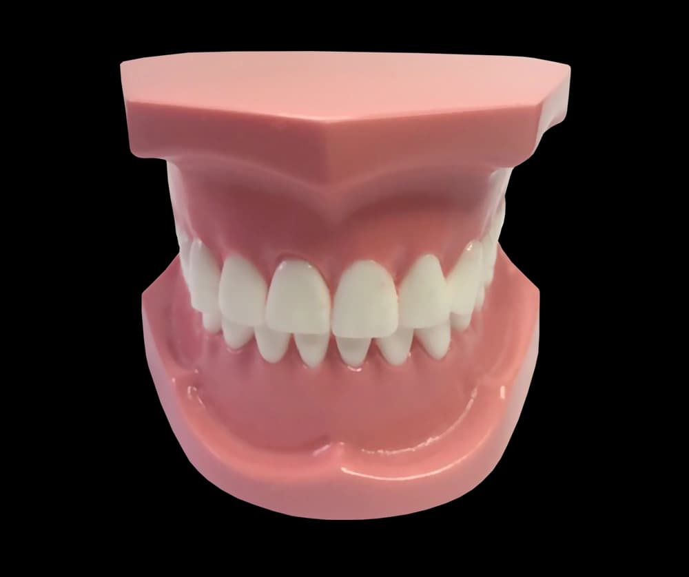I klasės ortodontinis modelis su breketais - oficiali GF Dental produkto nuotrauka