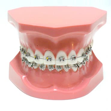 I klasės ortodontinis modelis su breketais - oficiali GF Dental produkto nuotrauka