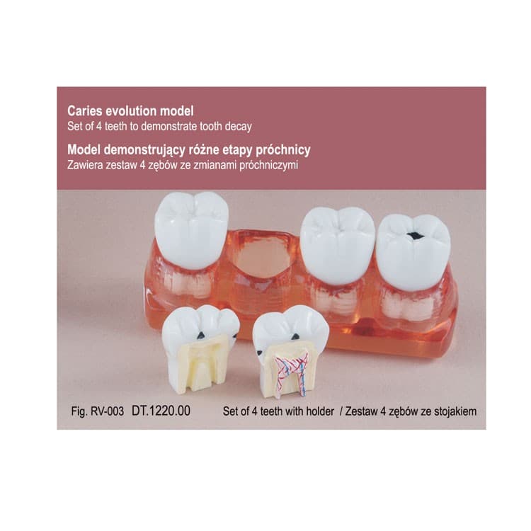 Real Series Caries evolution models set – oficiali Falcon Medical produkto nuotrauka