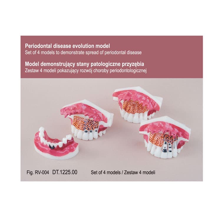 Real Series periodontal disease evolution models set – oficiali Falcon Medical produkto nuotrauka