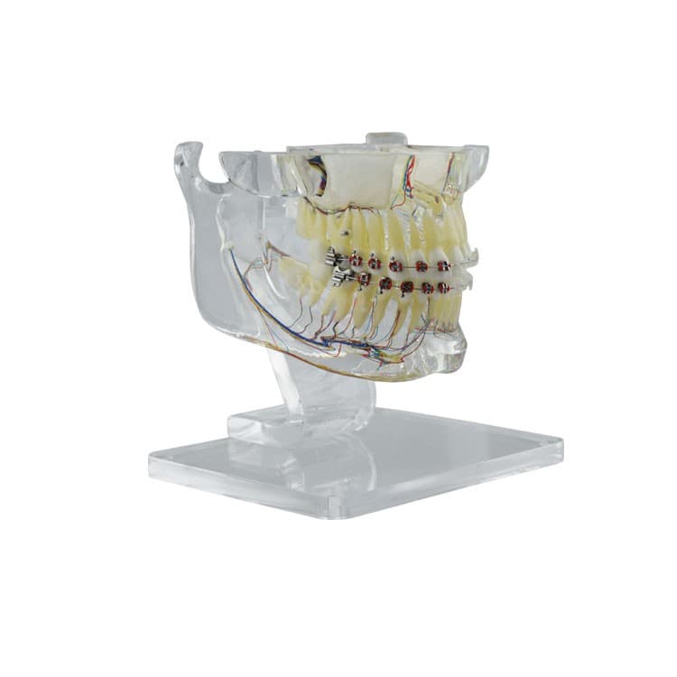 Real Series Desk-Top Orthodontic model with metal/cermamic brackets – oficiali Falcon Medical produkto nuotrauka