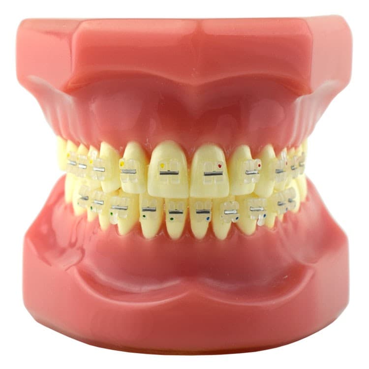 Typodont with Ceramika-III brackets Roth .022″ slot, hooks on 3, 4 & 5 – oficiali Falcon Medical produkto nuotrauka