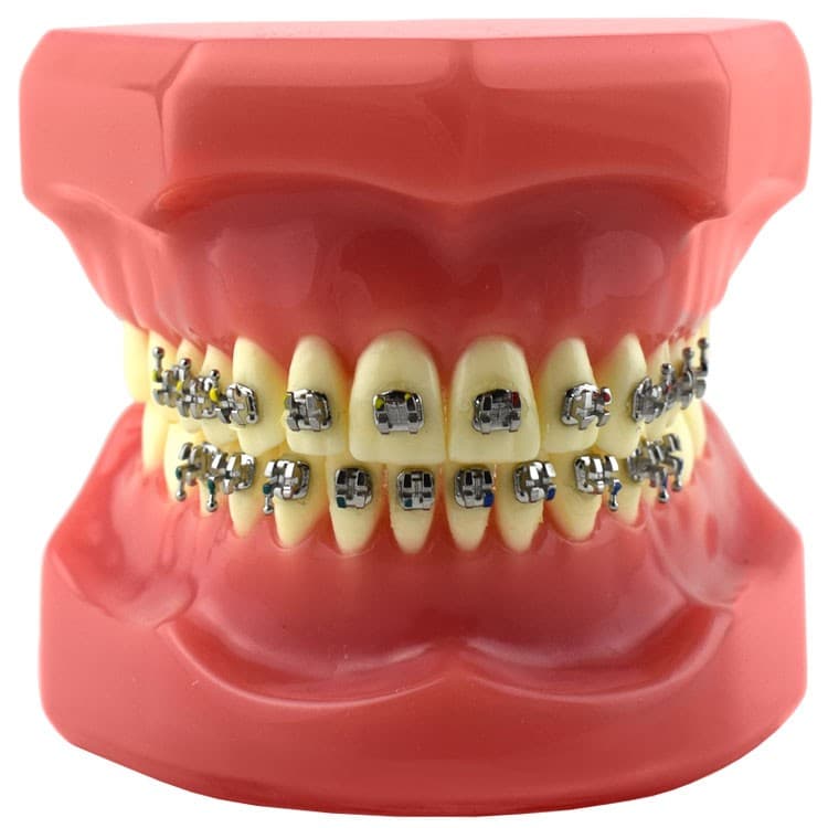 Typodont with brackets MARK-II Roth .022″, hooks on 3, 4 & 5 – oficiali Falcon Medical produkto nuotrauka