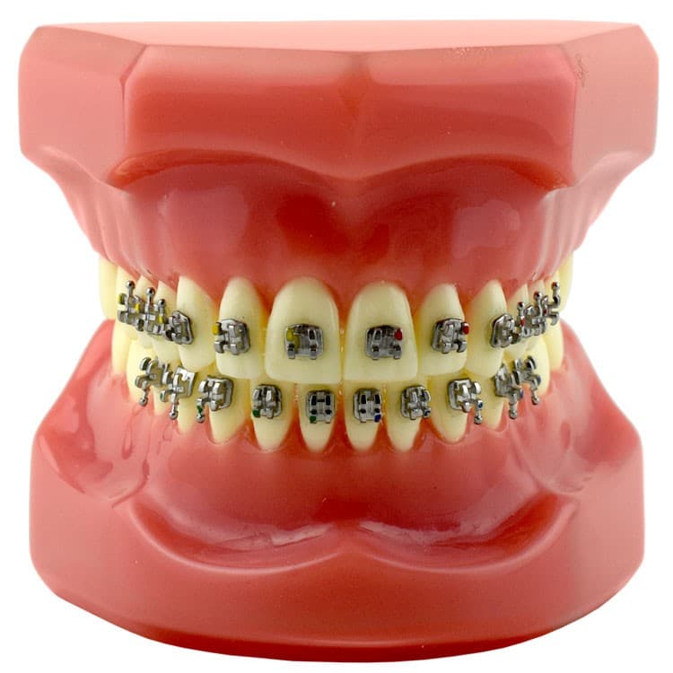 Typodont with brackets MARK-I Roth .022″, hooks on 3, 4 & 5 – oficiali Falcon Medical produkto nuotrauka